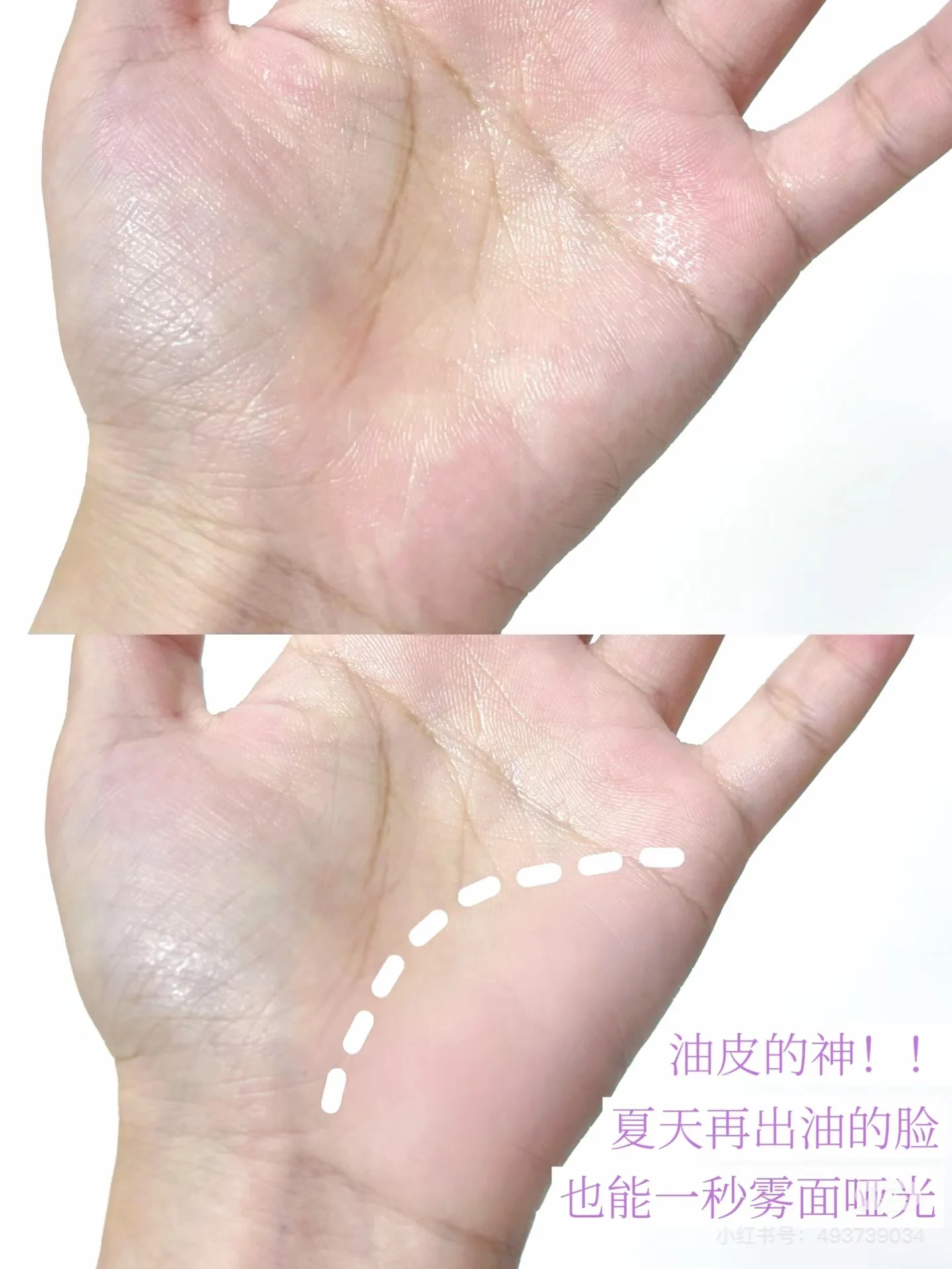 thumb