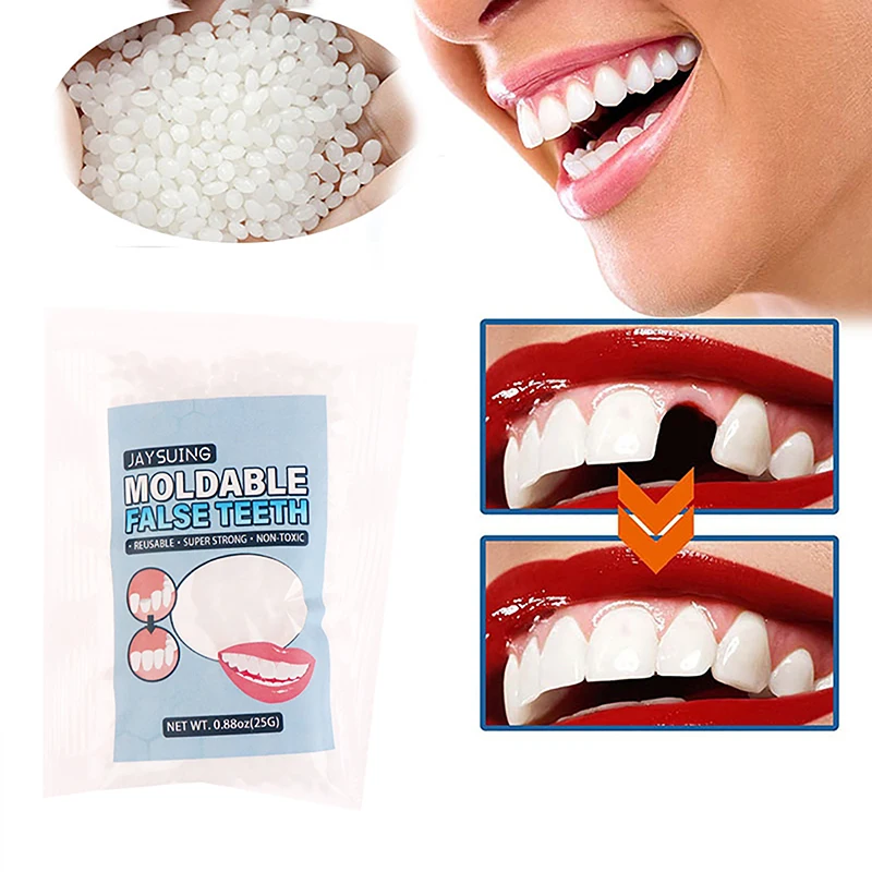 

1Pc 25g Reusable Resin Temporary Tooth Repair Kit Teeth And Gaps Solid Glue Denture Adhesive Teeth Whitening For Broken Teeth