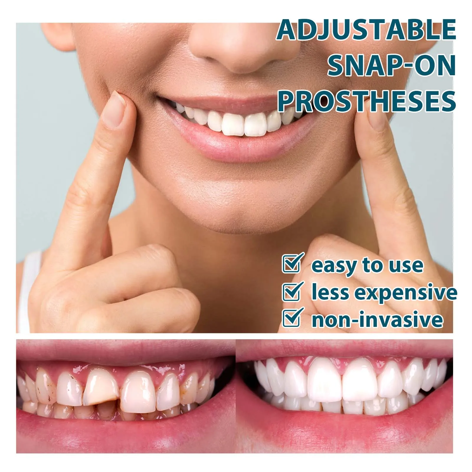 EELHOE-Dentes ajustáveis Whitening Set, dentes falsos, superior e inferior, facetas dentárias removíveis, dente falso, dentaduras sorriso perfeito