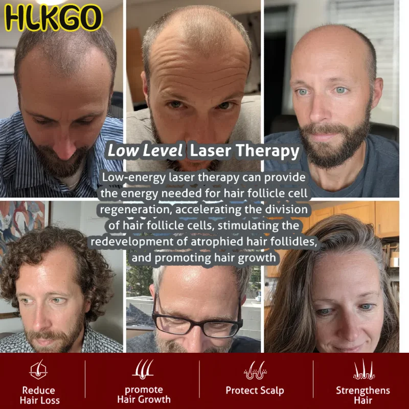 

Шапочка для роста волос с терапией красного света 650 нм, инфракрасный лазерный шлем для предотвращения выпадения волос и утолщения