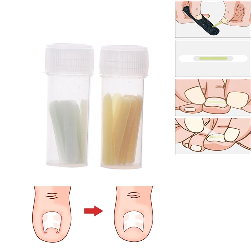 50pcs/Box Pedicure Foot Toe Nail Ingrown Toenail Correction Tool Nail Treatment Elastic Sticker Straightening Foot Care Tools