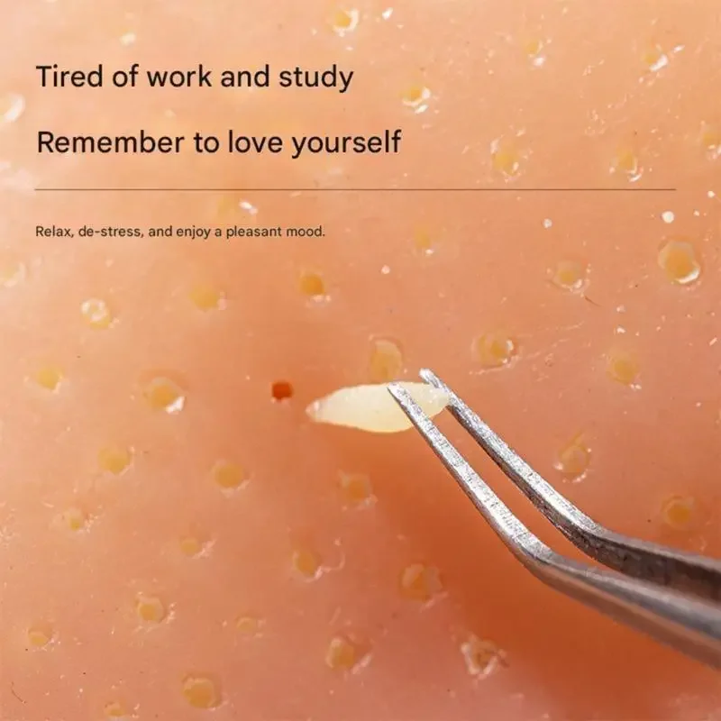 สมจริง Elastomer สิวเปิด Ease ของเล่นความแม่นยำ Pincers และขนส่งกระเป๋าสำหรับผู้ใหญ่เด็ก Perceptual 15UB