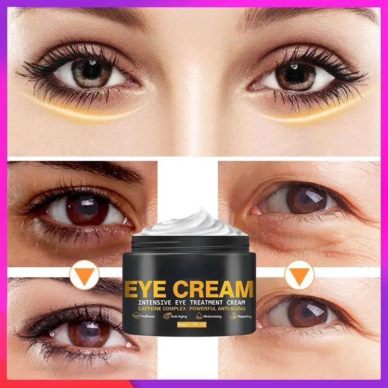 Crème anti-âge raffermissante pour les yeux, élimine les cernes et les poches sous les yeux, granule de graisse, anti-rides, nouvelle collection