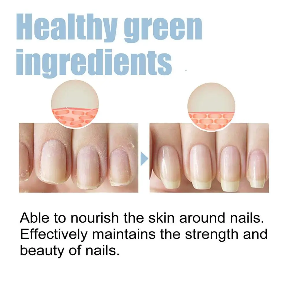 15ml Nail Repairing Liquid Nail Strengthener Nourishing Cream Soft Shining Nail Repair Serum For Home Finger Toe Nail Care H5X8