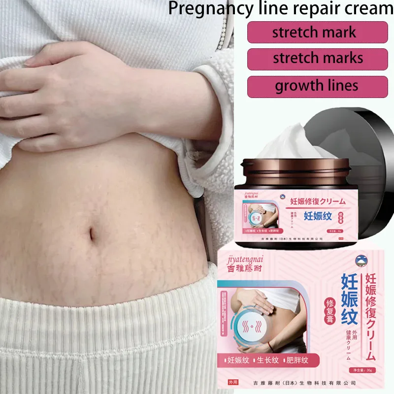 

Women's Stretch Mark Repair Cream, Postpartum Scar Cream for Cesarean Section, Post-Surgery Repair Gel to Reduce Stretch Marks