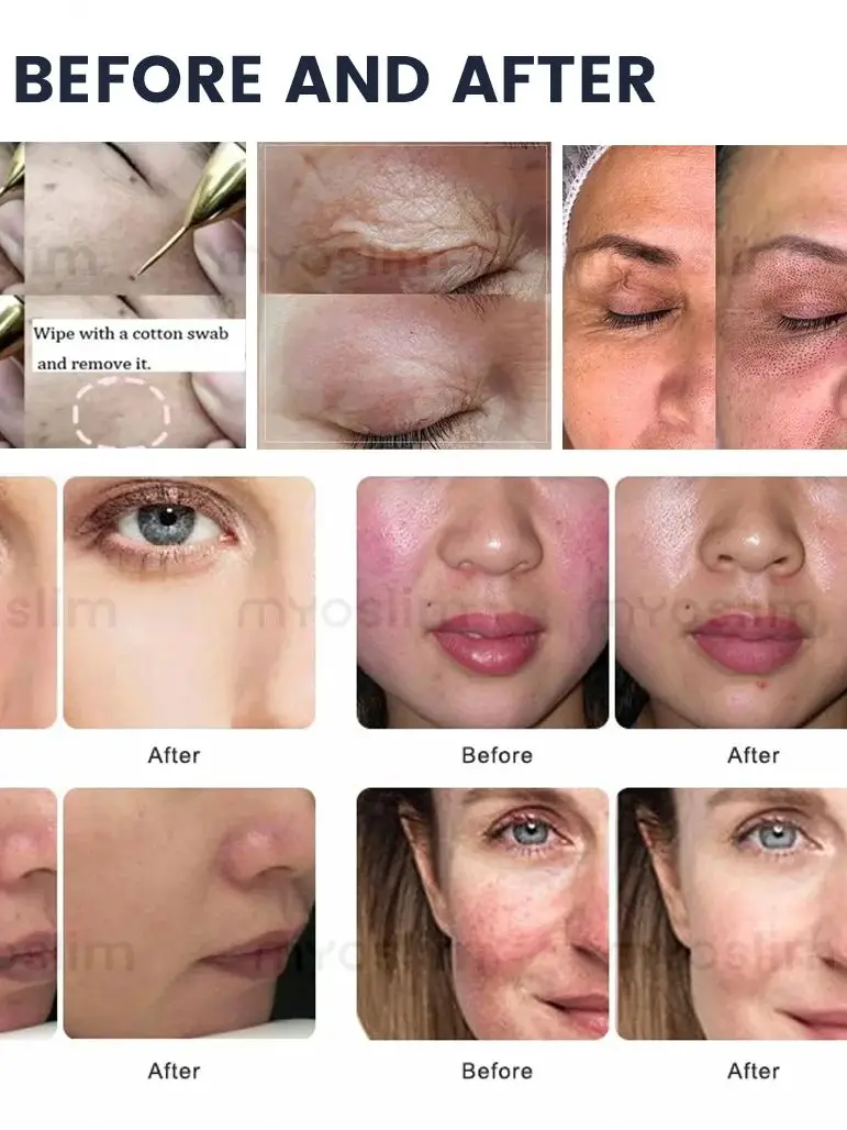 

New Beauty Salon Super Portable IPL Laser Hair Removal Machine Professional Equipment Diode Laser Permanent Hair Removal