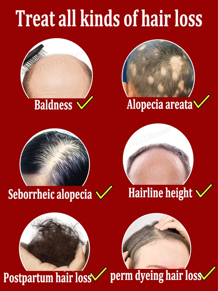 Prevent baldness, effectively repair hair loss, and regenerate hair