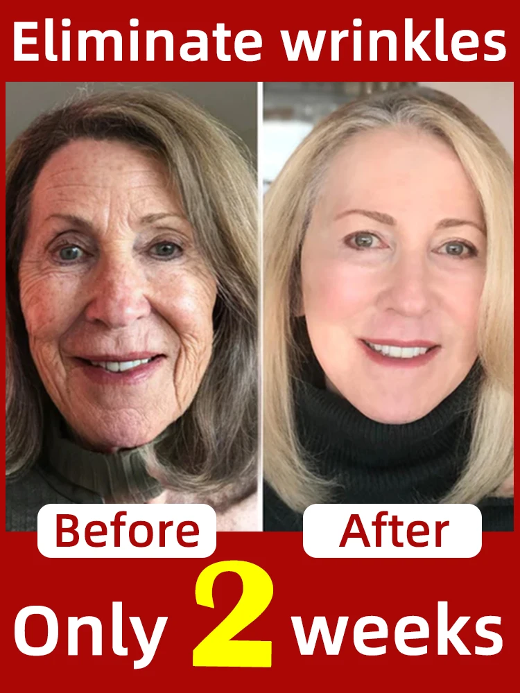 

Restore your skin to its youthful state