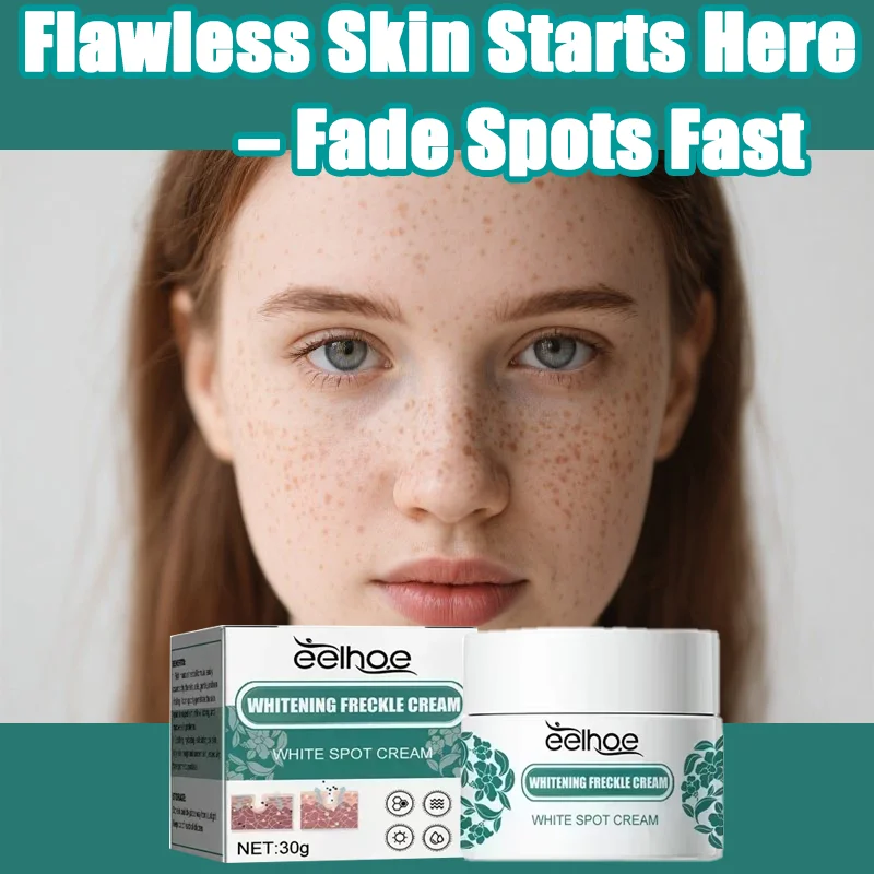 

Removal Dark Spots Whitening Freckle Cream Fades dark spots and hyperpigmentation Brightens dull skin Reduces melasma age spots