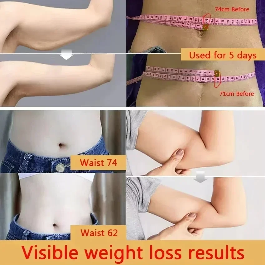 Effective Body Slimming Cream Fast Fat Burn Weight Loss Remove Belly Thigh Body Fat Keep Body Firming Anti Cellulite Body Care