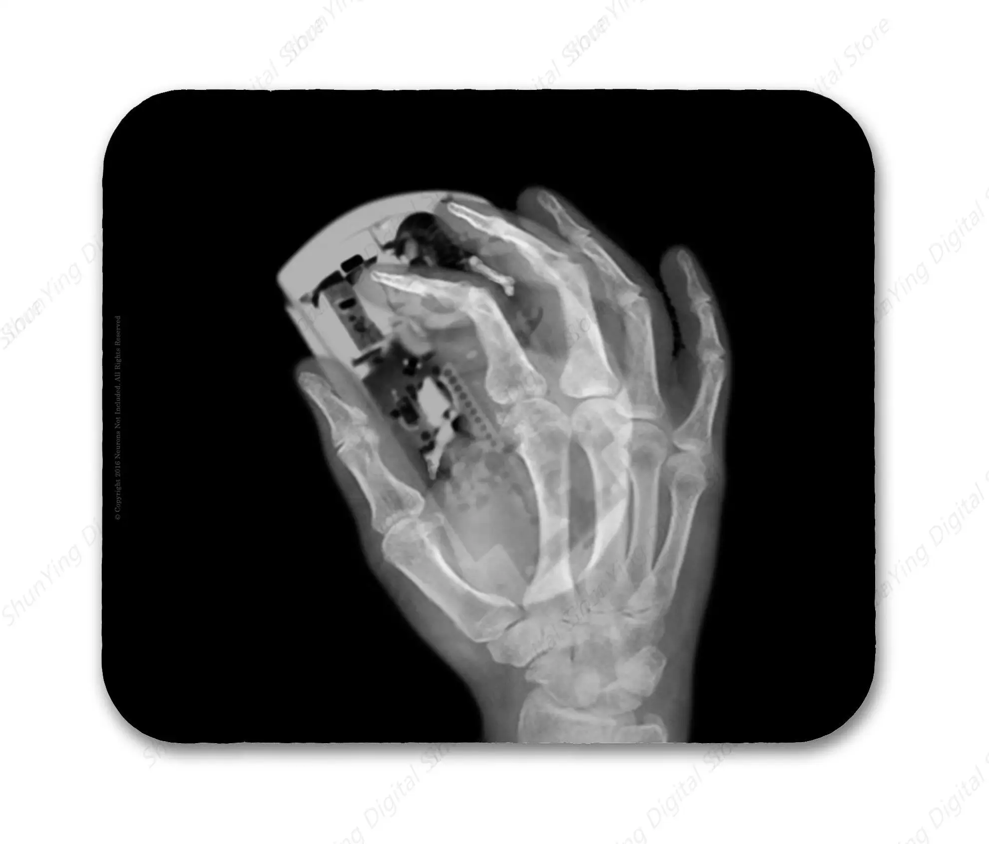 

Computer Mouse Pad Hand X-Ray Image Suitable For Gaming Office Laptop Mouse Pad 18*22cm