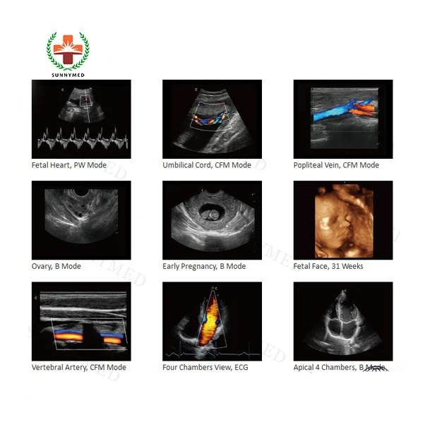 SY-A029 scanner trolley echografo ultrasound machine digital echo ecograpghy ultrasound wholesale price gynecological ultrasound