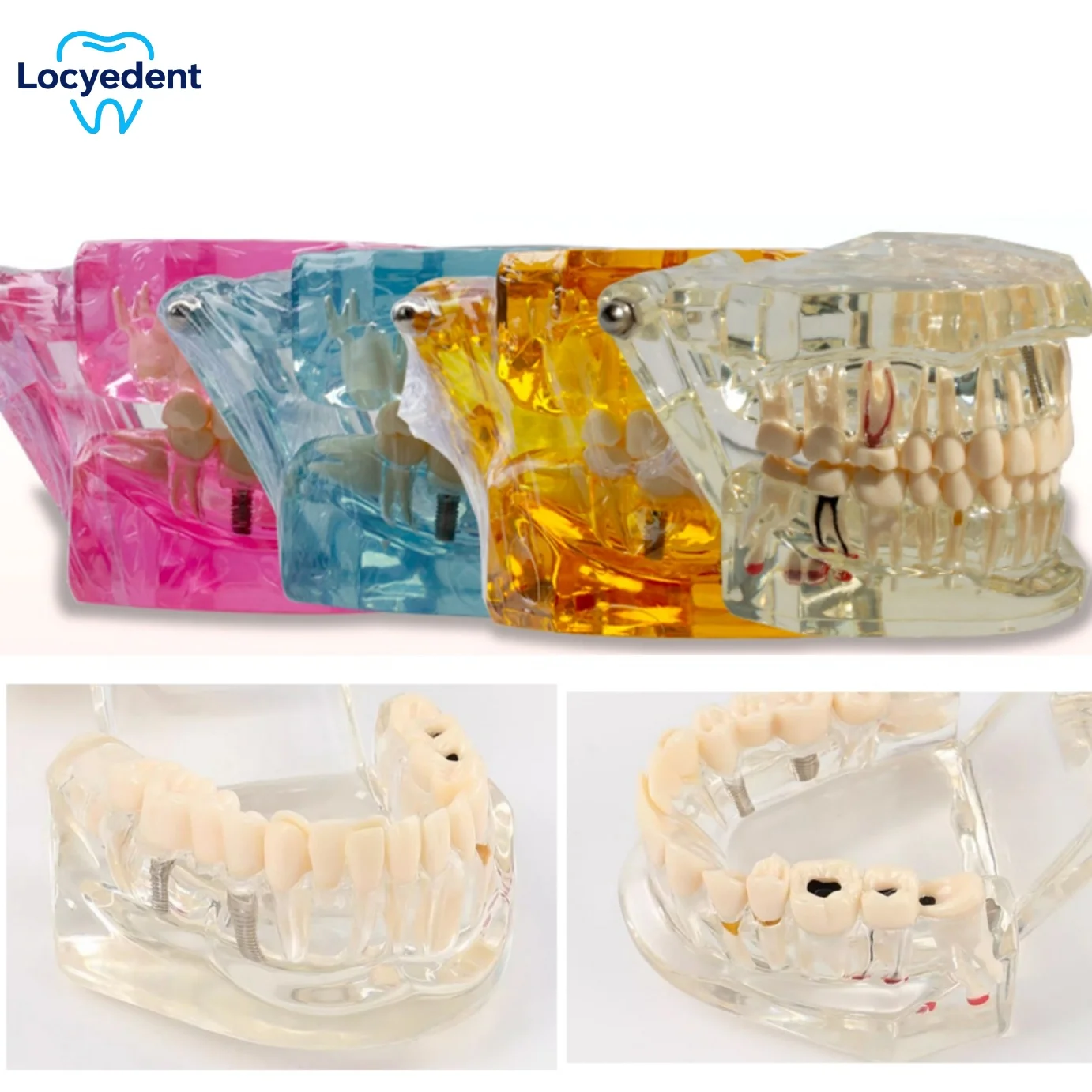 

Dental Teaching Model Study Removable Orthodontic Tooth Models Resin Dentist Material Implants Restoration Study Tool