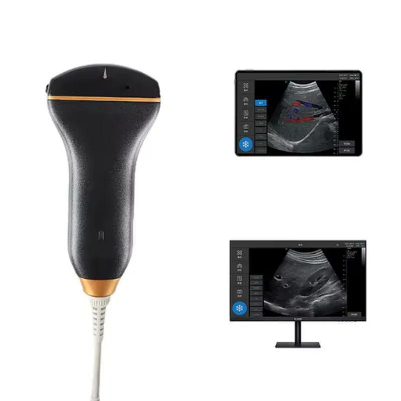 Medsinglong USB Wireless Handheld Ultrasound Scanner Medical Grade B-Mode Portable