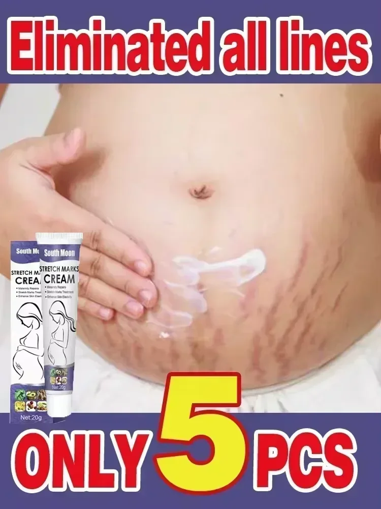 Permanent Removal Cream Eliminate Body Belly Stretch Marks For Tunnels  Effective Stretch Marks Cream Removes Stretch Marks