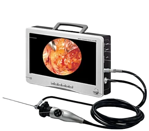 Full HD integrated imaging system 4 in one endoscope ent endoscopy endoscope camera