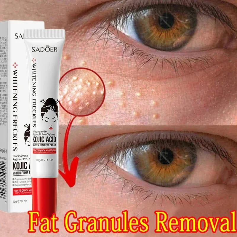 Fat Granules Remover Eye Cream Anti-Puffiness Reduce Dark Circles Fade Fine Lines Repair Barrier Firm Cream