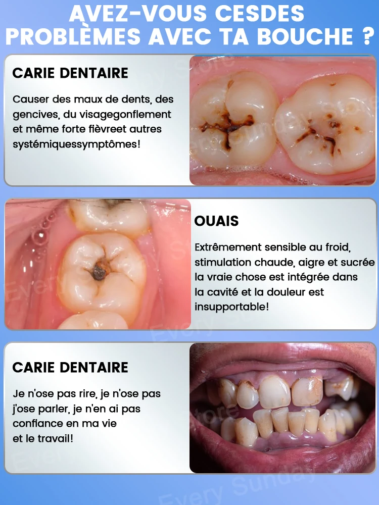 tooth decay