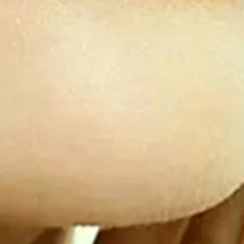 

Low Temperature Thermoplastic Nose Splint Nose Job Rhinoplasty Splint Ortho Immobilized Thermoplastic Nose Nasal Fracture Splint