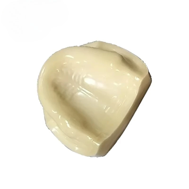 Edentulous Maxillary Cut Sutured ImplantS Model