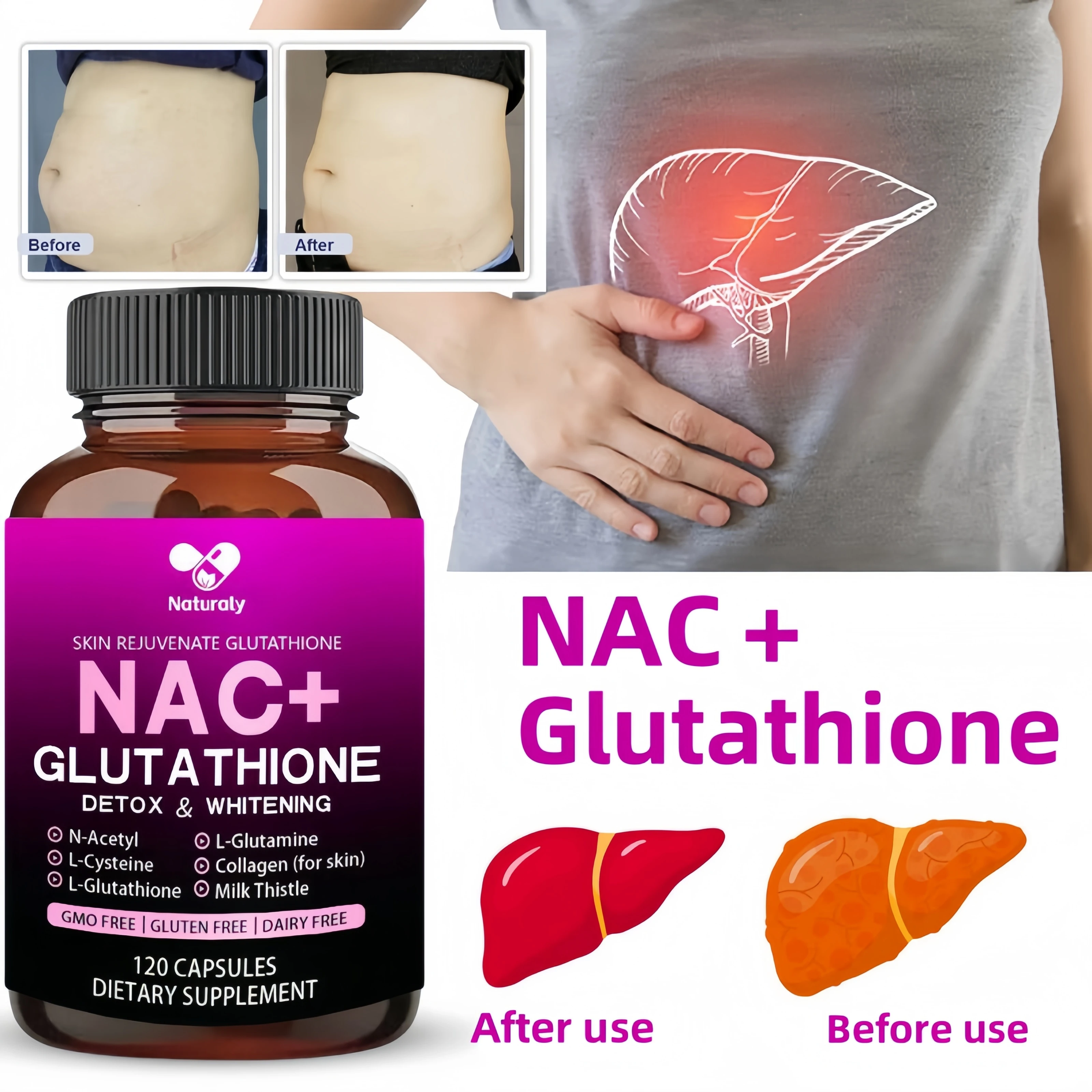 NAC+Glutathione Capsules – Detoxification, Whitening, Immunity, Cell Growth and Repair, Antioxidant Supplement