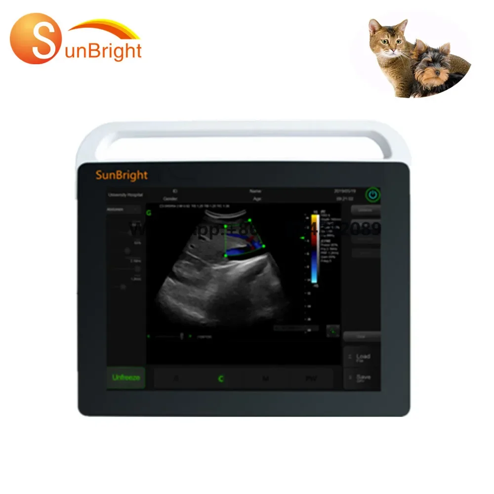 Portable ultrasound touch screen laptop ultrasound machine SUN-800S digital touch ultrasound machine