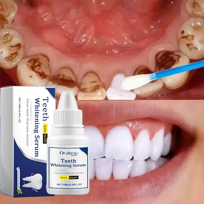 

Cleaning Tooth Whitening Serum Remove Plaque White Teeth Gel Teeth Yellow Smoke Stains Toothpaste Fresh Breath Oral Hygiene Care
