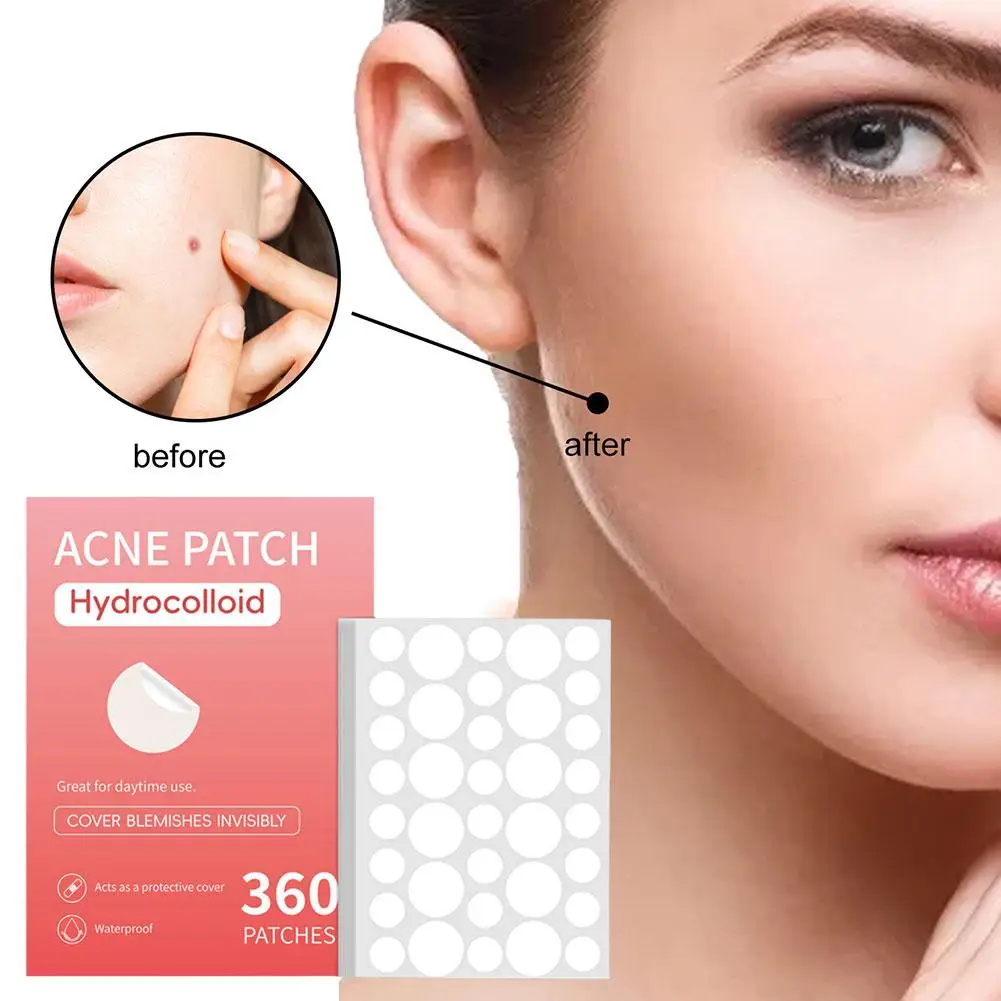 NEW High-end 360pcs Salicylic Acid Patch Invisible Hidden Pus Oil Pimple Absorb And Patch Tool Granules Patch Acne Remover N7A3