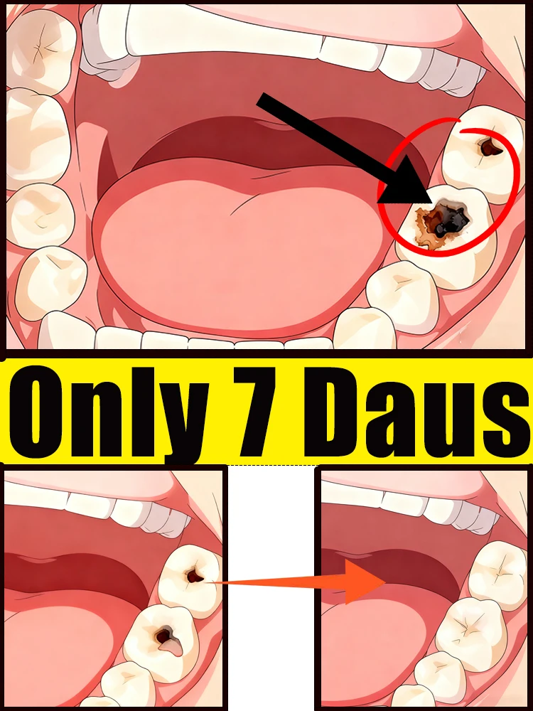La limpieza caliente de la venta 2025, protege varios problemas herramientas de cuidado intraoral