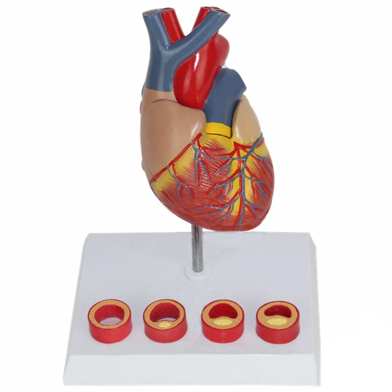 Education Model  Vascular Heart Anatomy Model Heart Blood Vessel Specimen