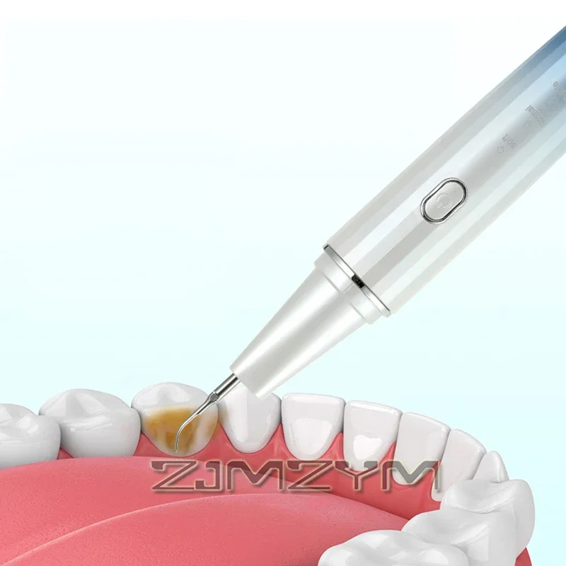Escalador Dental ultrasónico multifuncional, modo de limpieza Dental de 4 velocidades, instrumento Dental doméstico con 360 °   Punta de trabajo giratoria