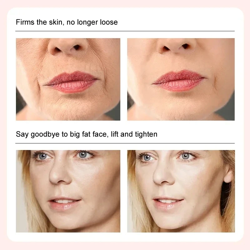 Meiyanqiong Firming Face Cream Moisturizing Whitening Face Care Anti-winkle Anti Aging V-face Thin Face Cream