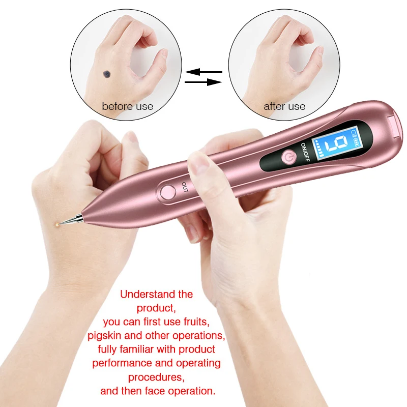 Skin Tag Remover Pen Dark Spot Remover Mole Tattoo Removal Laser Plasma Pen Machine Beauty Care Flat Blemish Pimples Removal Pen