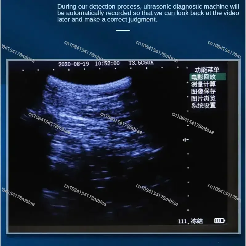 

5.6 Inch LCD Screen Portable Veterinary Ultrasound Scanner For Cattle Cow Pig Horse Ultrasound pregnancy testing Machine Color