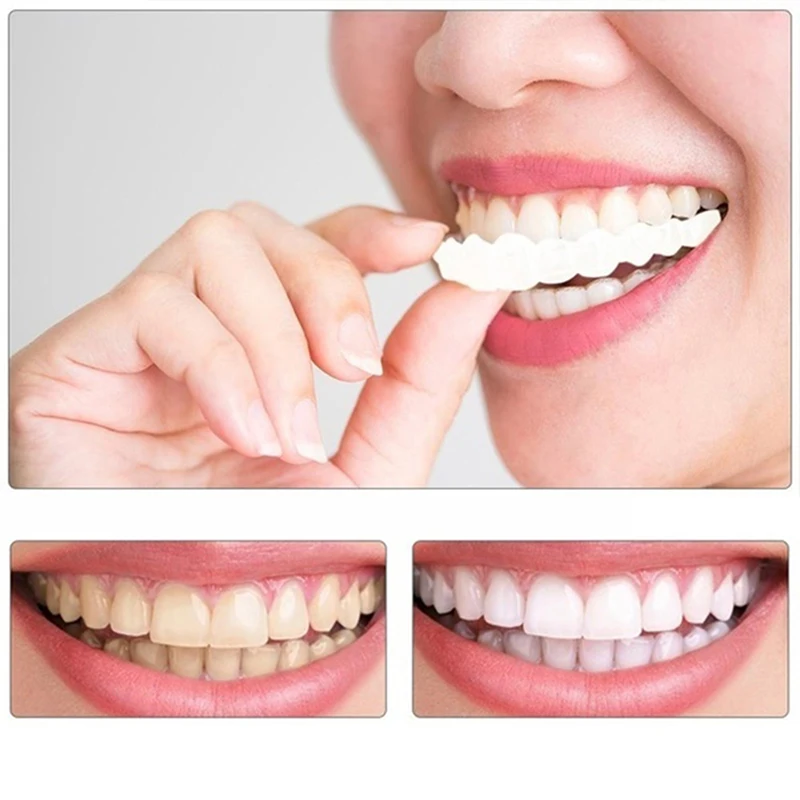 High Quality Guaranteed Veneers Dental Teeth Smile Denture Teeth Dental Teeth Cosmetic Veneer