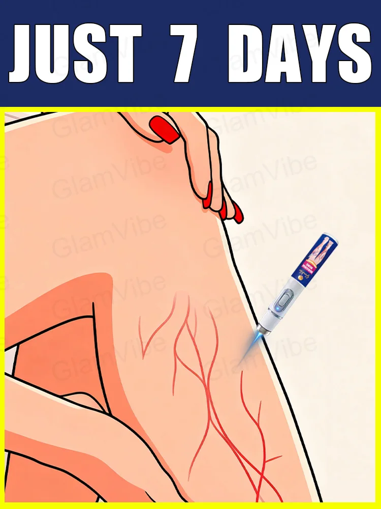 Bolígrafo de luz azul para resolver venas varicosas, gran oferta de herramientas para el cuidado de las piernas