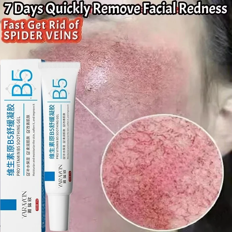 Facial Redness Repair Cream Improve Sensitive Skin Dryness Moisturizer Hydrating Sooth Lotion Removal Rosacea Korean Cosmetics