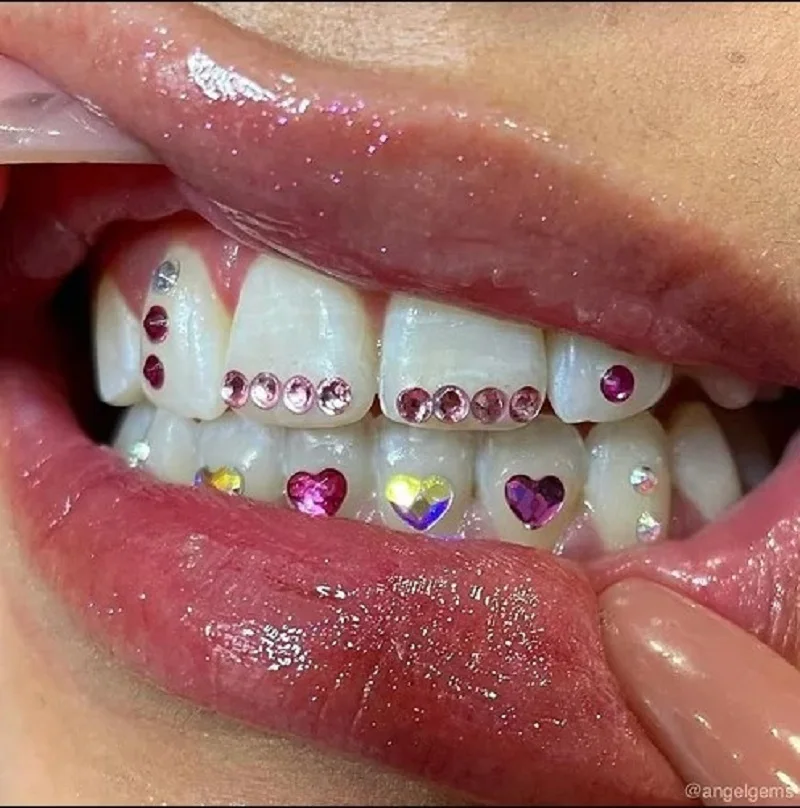 Professional Tooth Gem Kit 2026 Full Set DIY Starter Light Cure Crystal Jewelry Teeth Decorations for Dental Decoration