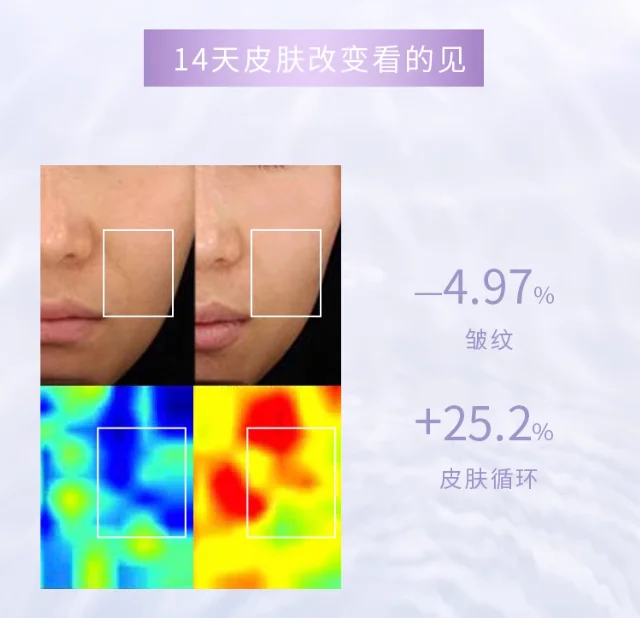 Micro-courant thérapeutique inductif pour les yeux, améliore la relaxation du visage, livraison gratuite