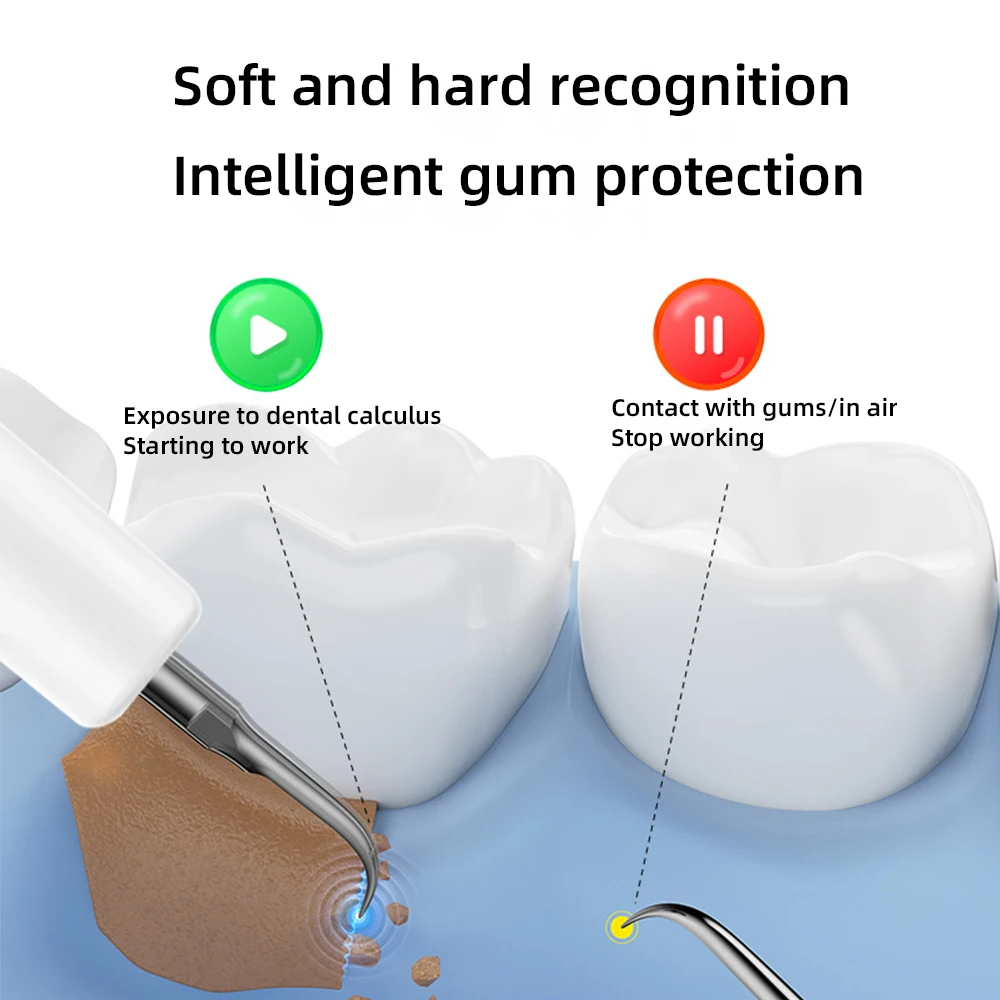 Оптовая продажа, звуковая зубная щетка для чистки полости рта для взрослых, портативный электрический ультразвуковой очиститель зубов, зубной скейлер, удаляет налет, пластик
