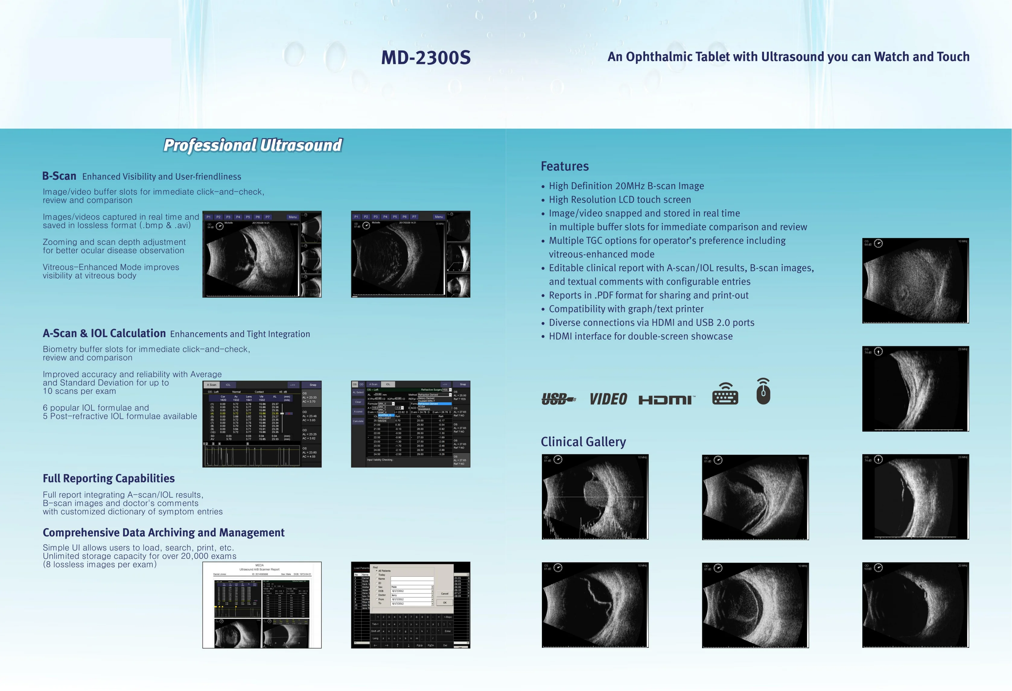 ESCÁNER A/B ULTRASÓNICO MD-2300S-AB para OPHTHALMOLOGÍA