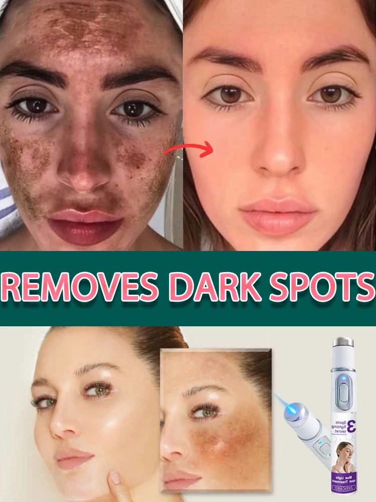 

И акisikuru agyiraehy иннова, мелазмы, nsensaneeAtomum, ne mfe a obi adi ho nsensanee no fi h уве nt lanam