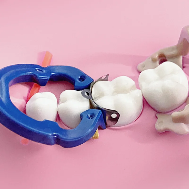 50 قطعة/صندوق، قطع على شكل حبوب الأسنان، ترميم بين القرب، فتحات/فتحات MOD من الدرجة الثانية، حشوة الأملام الراتنج/الفضة المساعدة