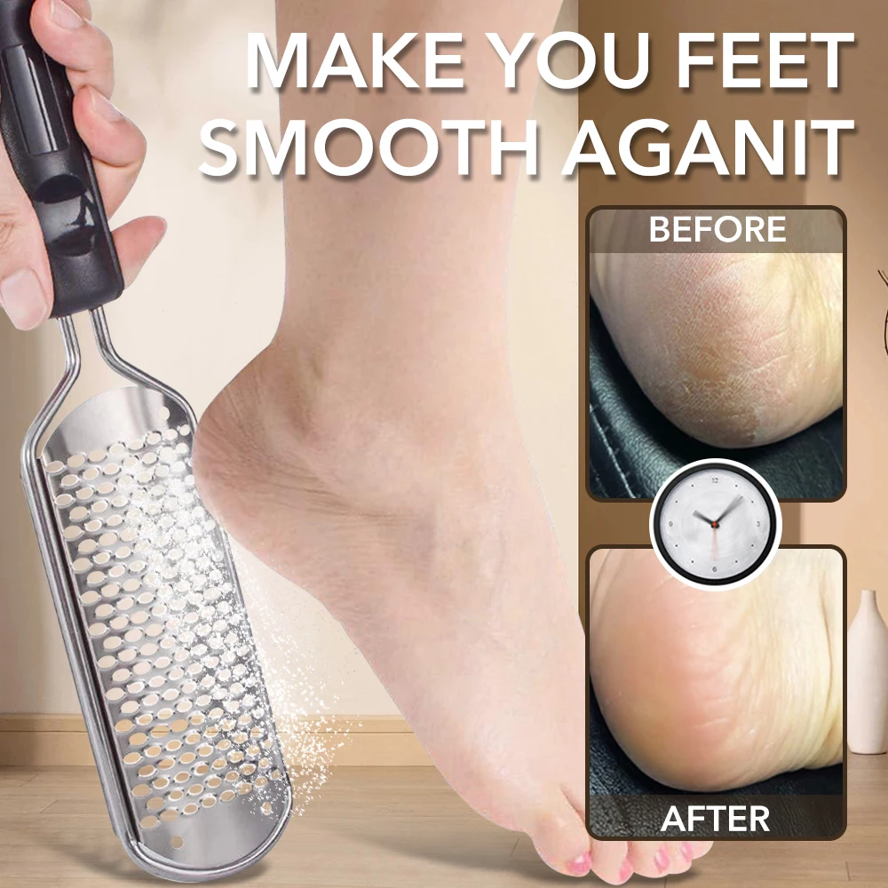 1/2/4Pcs Foot File Foot Scrubber Pedicure Callus Remover Professional Foot Scraper Cracked Dead Skin Remover for Dry Wet Feet