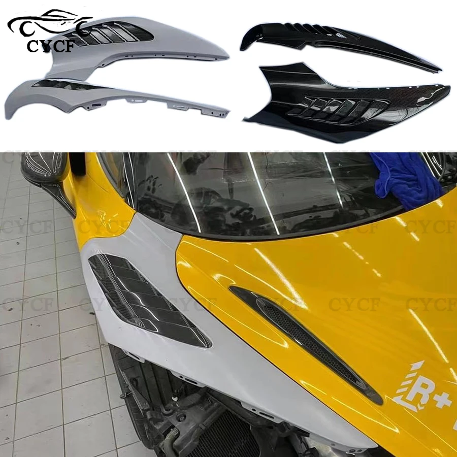 

Really Carbon Fiber For McLaren 720S Car Front Side Fender Trim Decorative Open-hole Fender Car Accessories Body Kit