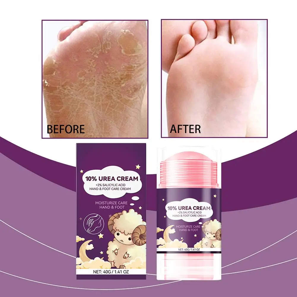 40g Korean Nourishing Hand And Foot Cream Moisturizing Exfoliating For Feet Pedicure Cream Feet For Very Dry Skin Winter Be L6a6