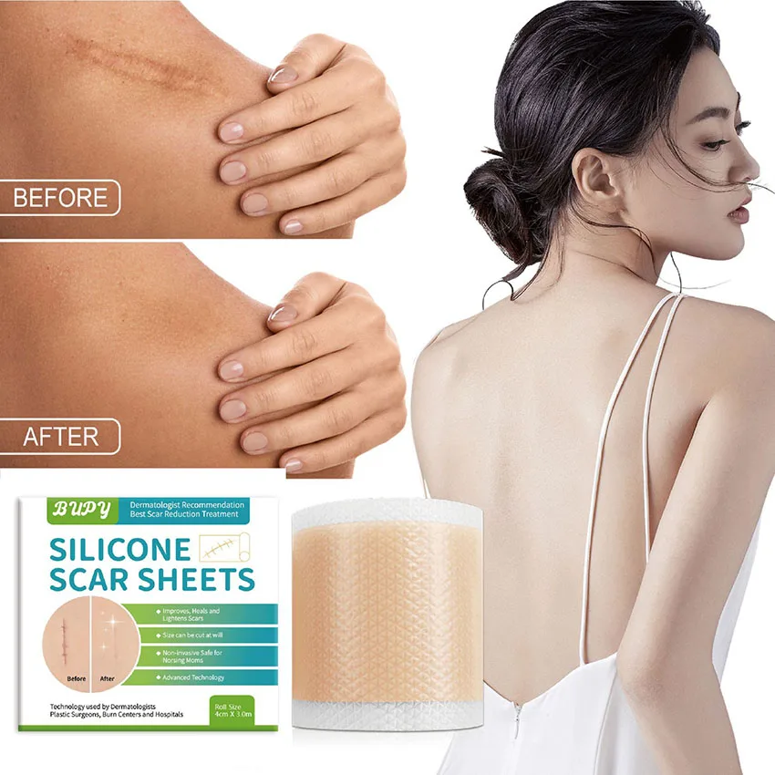 3-Meter BUPY Silicone Self-adhesive Scar Roll for Smooth Skin Care Fading Pregnancy Surgical Scars Repairing Scars