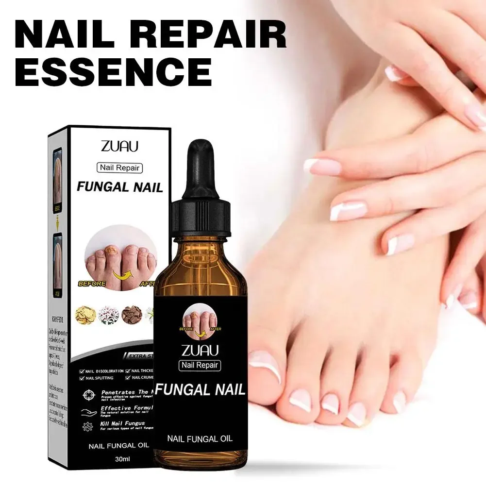 Nail Fungals Renewal Nail Repair Liquid for Discolored Thickened Crumbled Nails Nail Fungals for Discolored Broken Cracked