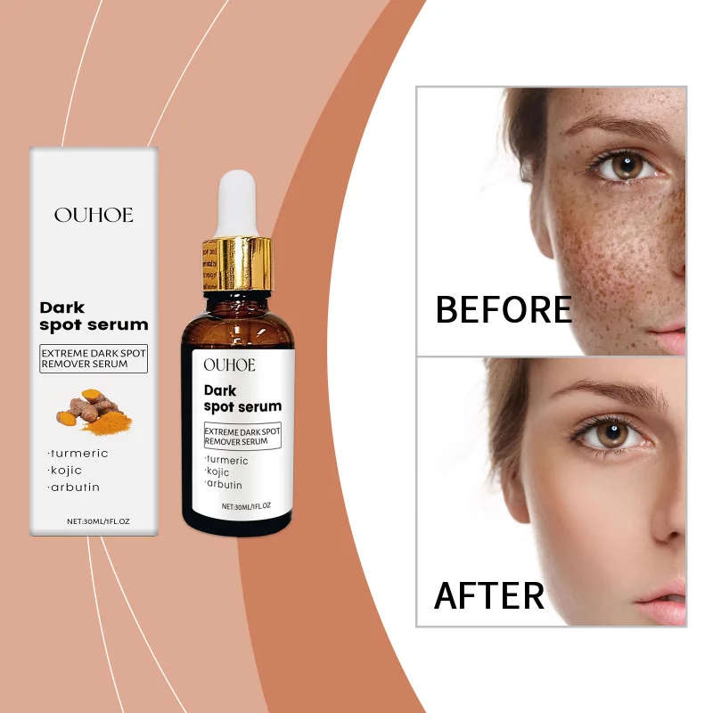 

Moisturizing Essence For Gentle Nourishment, Hydrating, Moisturizing & Refining Skin, Ideal For Facial Care Needs