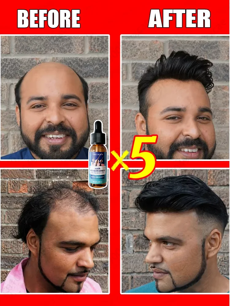 Hot sale, buyers will buy again, hair is getting more and more, say goodbye to baldness, sparse hair starts to become thick